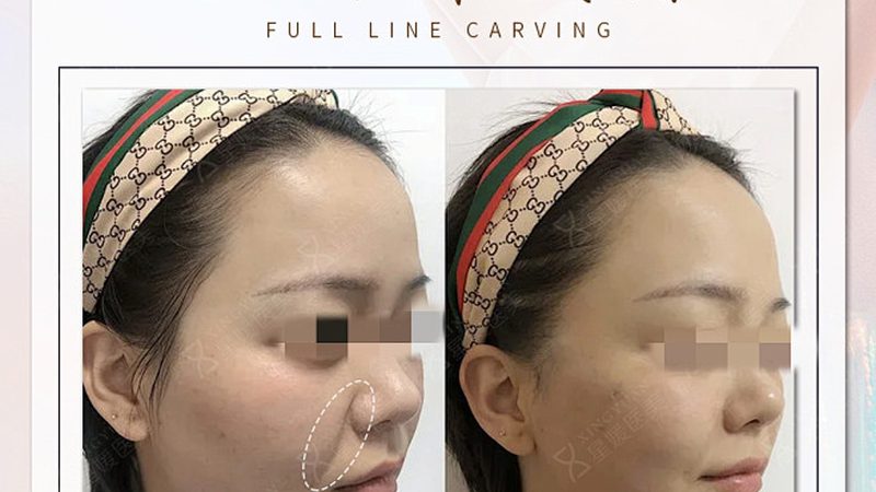 揭秘皮肤管理加盟：费用构成与后期收费解析