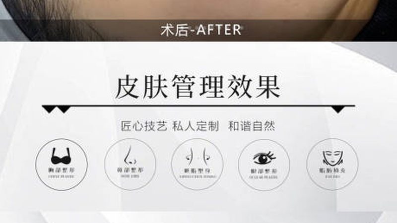 注射美容禁忌人群怎么判断
