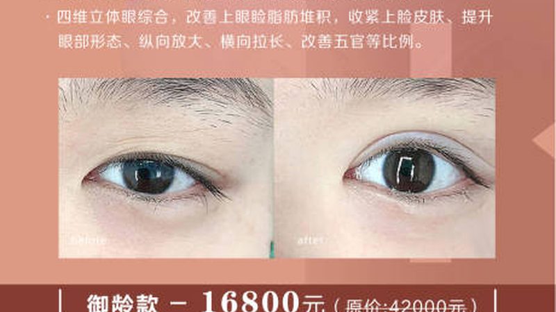超声炮治疗：揭秘费用构成与合理预期**