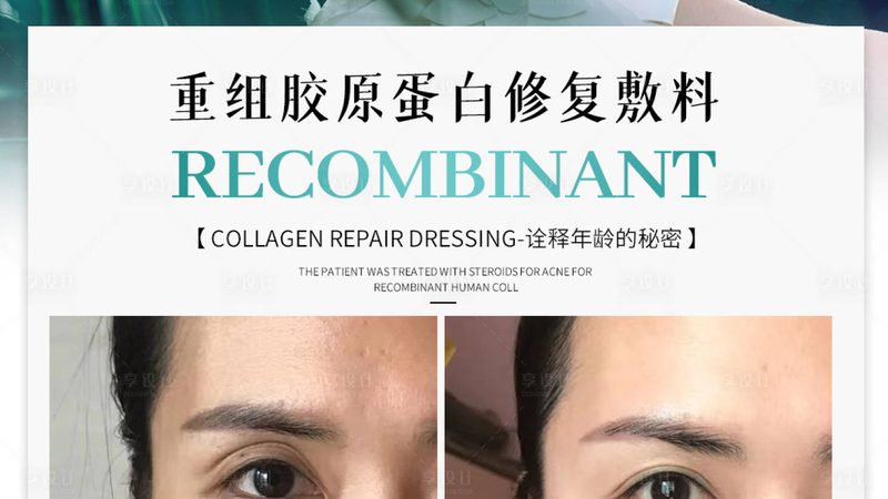 美容院超声炮设备：揭秘其工作原理与选购要点