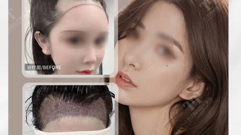 广州医美面膜：揭秘生产背后的秘密与选择要点