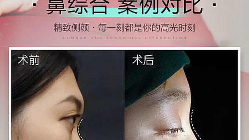 激光祛斑反黑能不能用淡斑精华