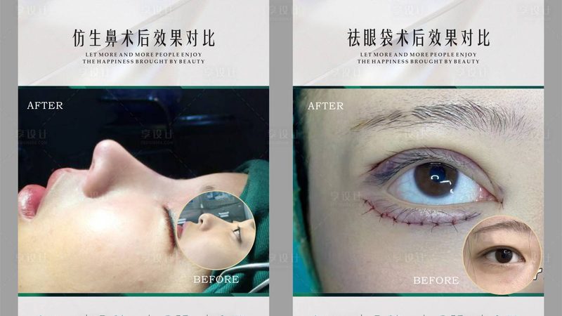家用抗衰仪器的选型逻辑：如何从众多型号中找到最适合你的**