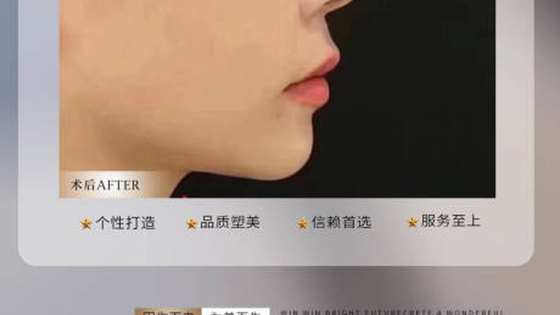 家用光子嫩肤仪十大品牌排名