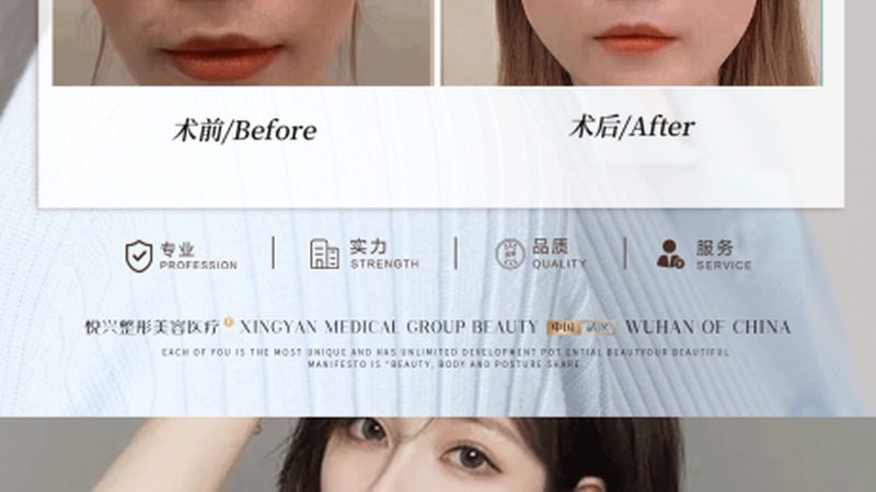 广州微整形诊所费用构成解析**