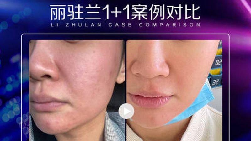 美容院与医院皮肤管理，揭秘靠谱之选