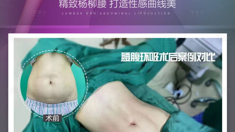 成都光子嫩肤仪器批发市场：揭秘光子嫩肤技术的秘密