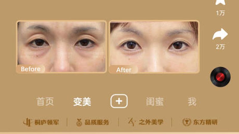 轻医美仪器厂家直销：揭秘流程步骤，确保安全可靠