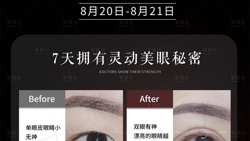 埋线提升效果能维持多久？揭秘其持久秘密**