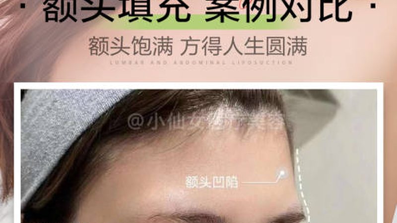 成都水光针保养，揭秘如何挑选优质医院