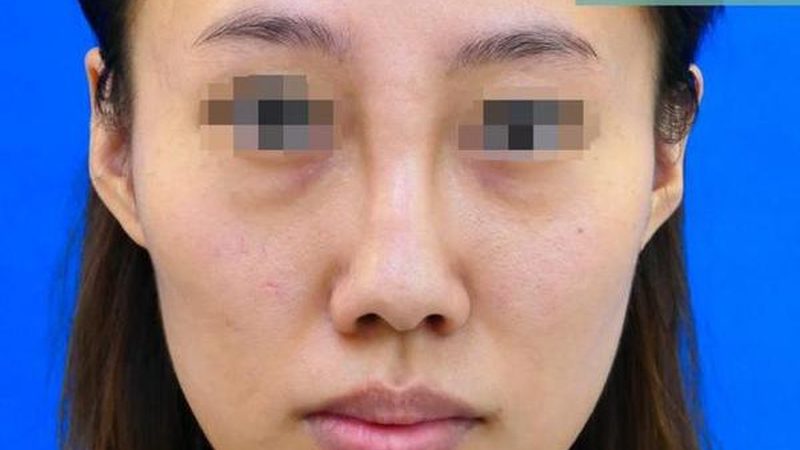 医疗美容与轻医美，揭秘两者的本质区别